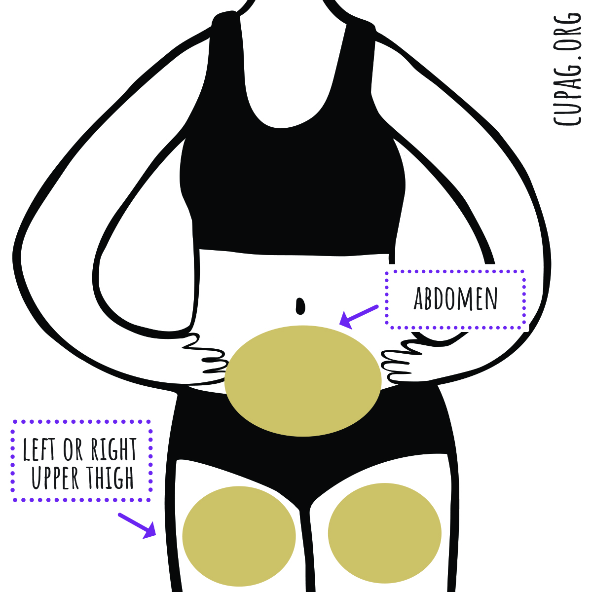 Illustration showing locations depo is injected highlighting the abdomen and upper thighs