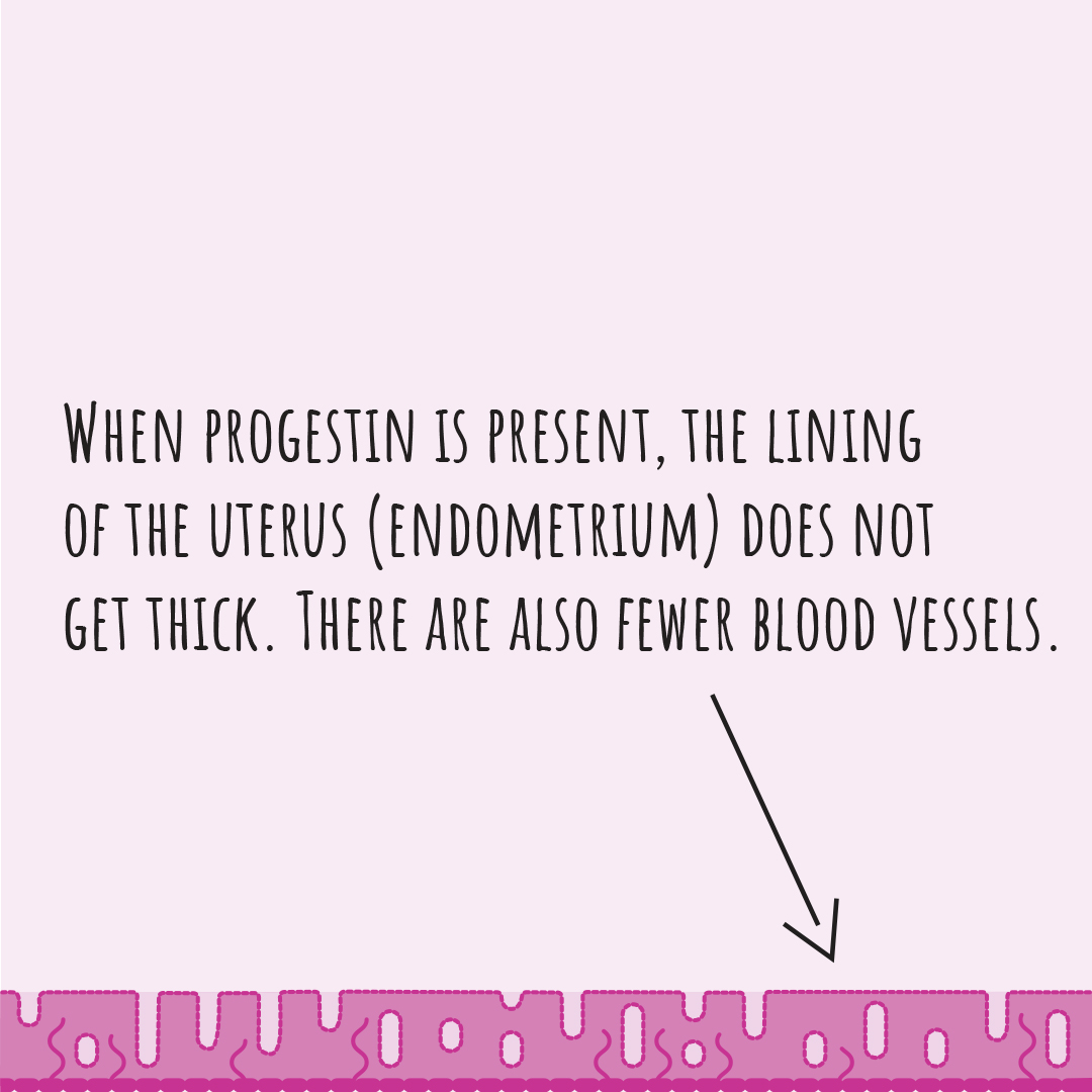 Illustration showing that when progestin is present, the lining of the uterus does not get thick, and there are fewer blood vessels.