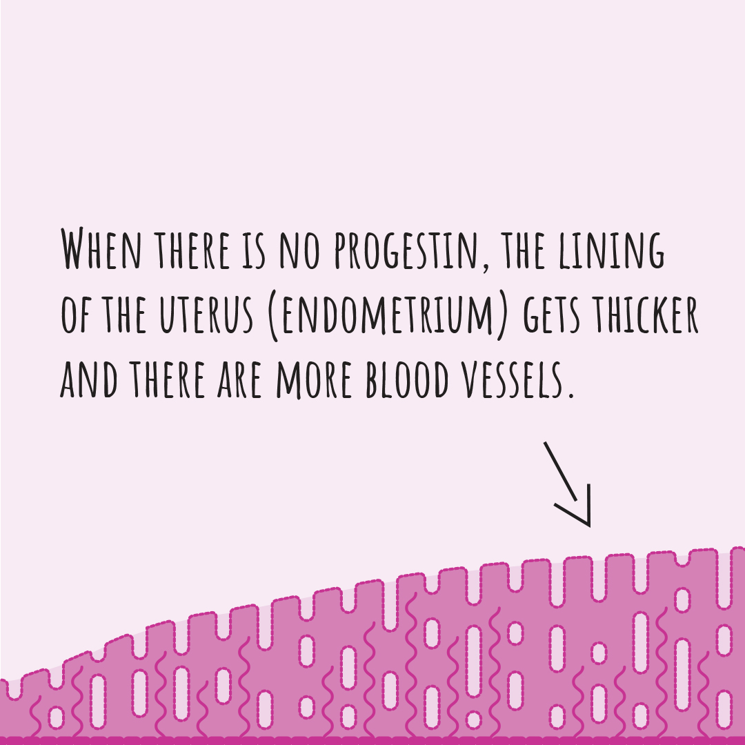 Illustration showing that when there is no progestin, the lining of the uterus gets thicker and there are more blood vessel.